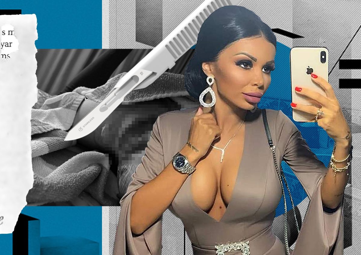 Imagine Stire Scandal uriaș cu ex-nora lui Sile Cămătaru și esteticianul care i-a făcut mărirea de fese. Coșmarul Andreei Duță: ”Mi-a căzut pielea de pe mine!” | 2review.ro