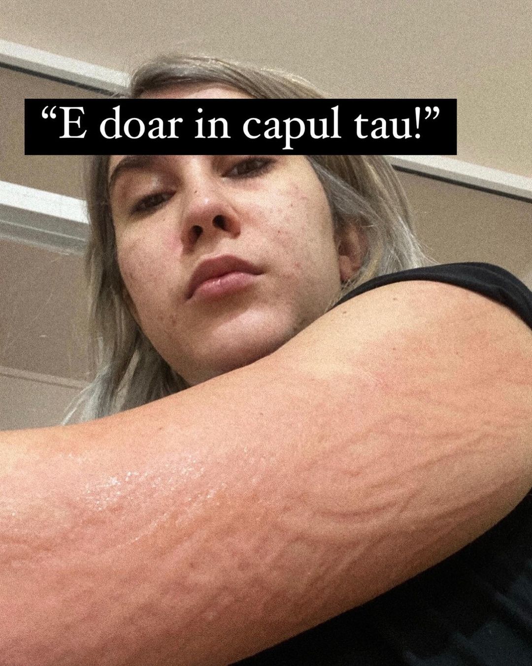 Adda, după ce medicii spuneau că doala este doar în mintea sa. Sursă foto: Facebook