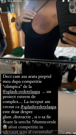 Postarea Vicăi pe instagram după ce s-a accidentat la Splash