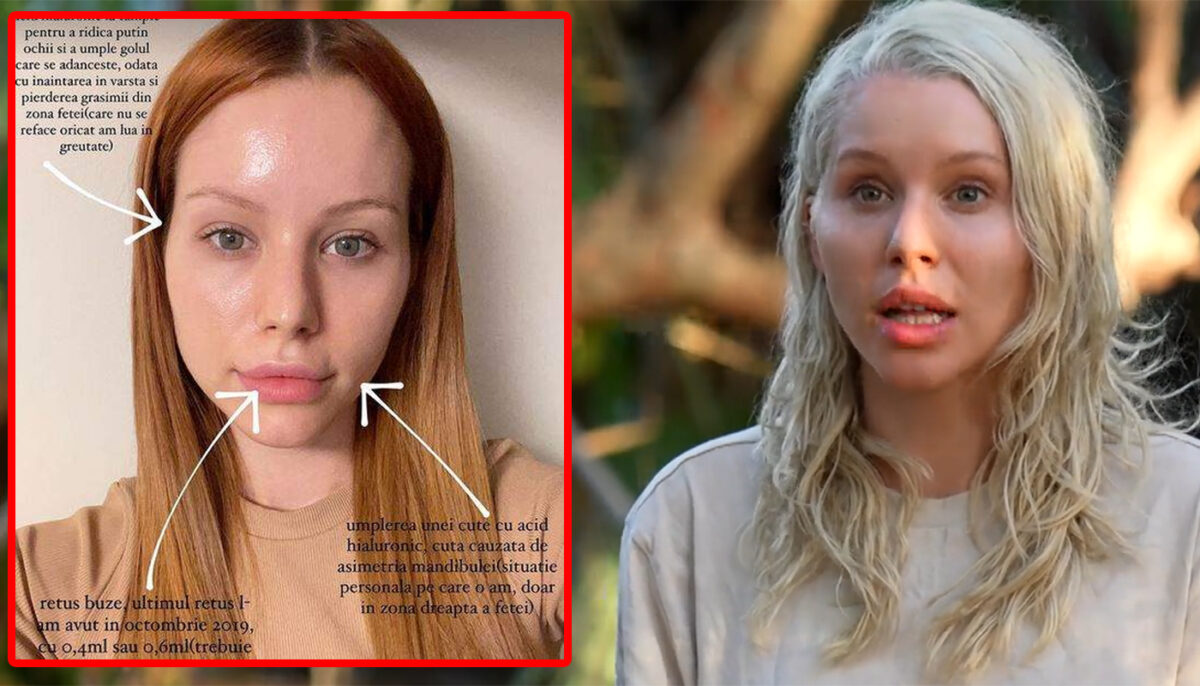 Imagine Stire Cum arăta Carmen Grebenișan de la Survivor 2023, înainte să își facă operațiile estetice. Blonda de la Pro TV zici că-i alt om! | 2review.ro