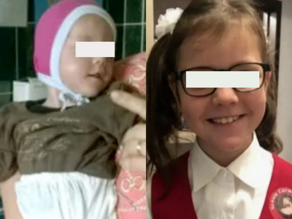 Cum arată acum fetița care a crescut cu pufuleți până la 4 ani: ”Când s-a văzut a început să plângă”