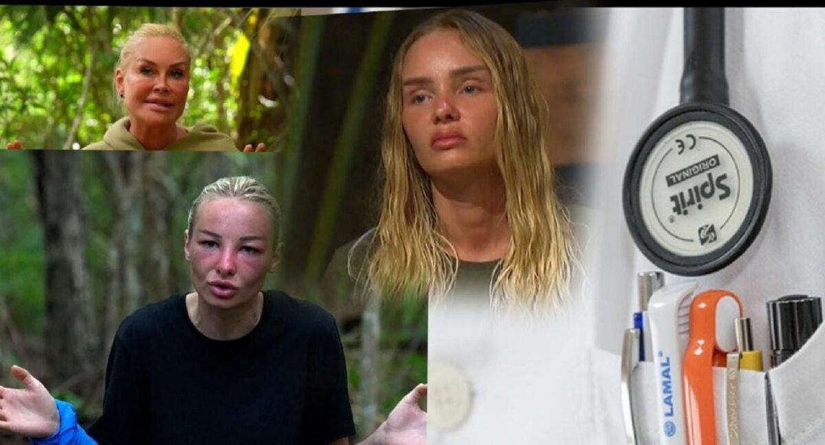 Imagine Stire Motivul bizar pentru care concurentele Survivor se umflă la faţă în Republica Dominicană. Ce se întâmplă, de fapt, cu ele | 2review.ro