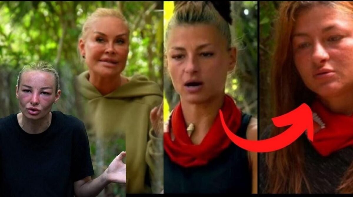 Imagine Stire Motivul bizar pentru care concurentele ,,Survivor” se umflă la faţă în Republica Dominicană. Ce se întâmplă, de fapt, cu ele | 2review.ro