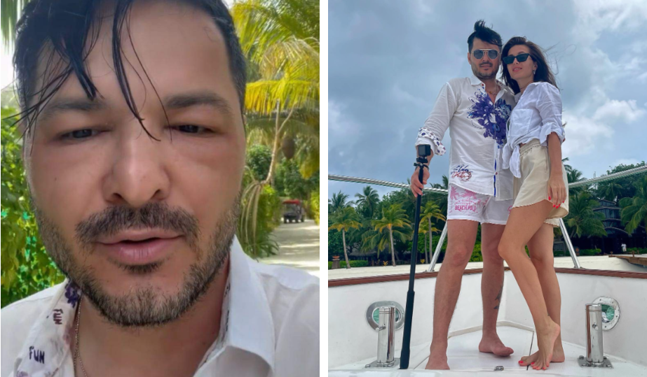 Imagine Stire Liviu Vârciu, probleme de sănătate în Maldive! Prezentatorul de la Antena 1 a apărut cu fața umflată | 2review.ro
