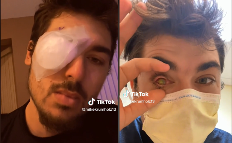 Ireal! Viața unui tânăr s-a schimbat radical după ce a ațipit cu lentile de contact în ochi. Diagnosticul medicilor a fost crunt