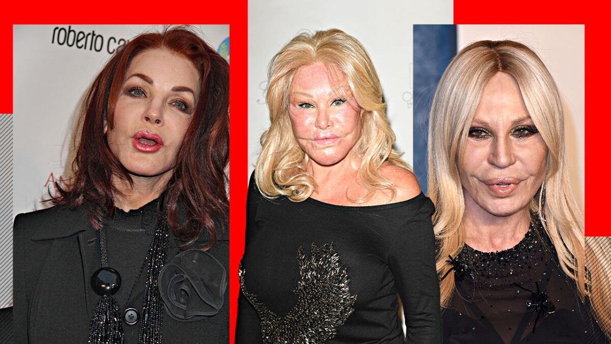 Imagine Stire TOP 5- Vedete de la Hollywood care s-au ales cu chipul desfigurat în urma operațiilor estetice. Jocelyn Wildenstein sau Donatella Versace arată de nerecunoscut! | 2review.ro