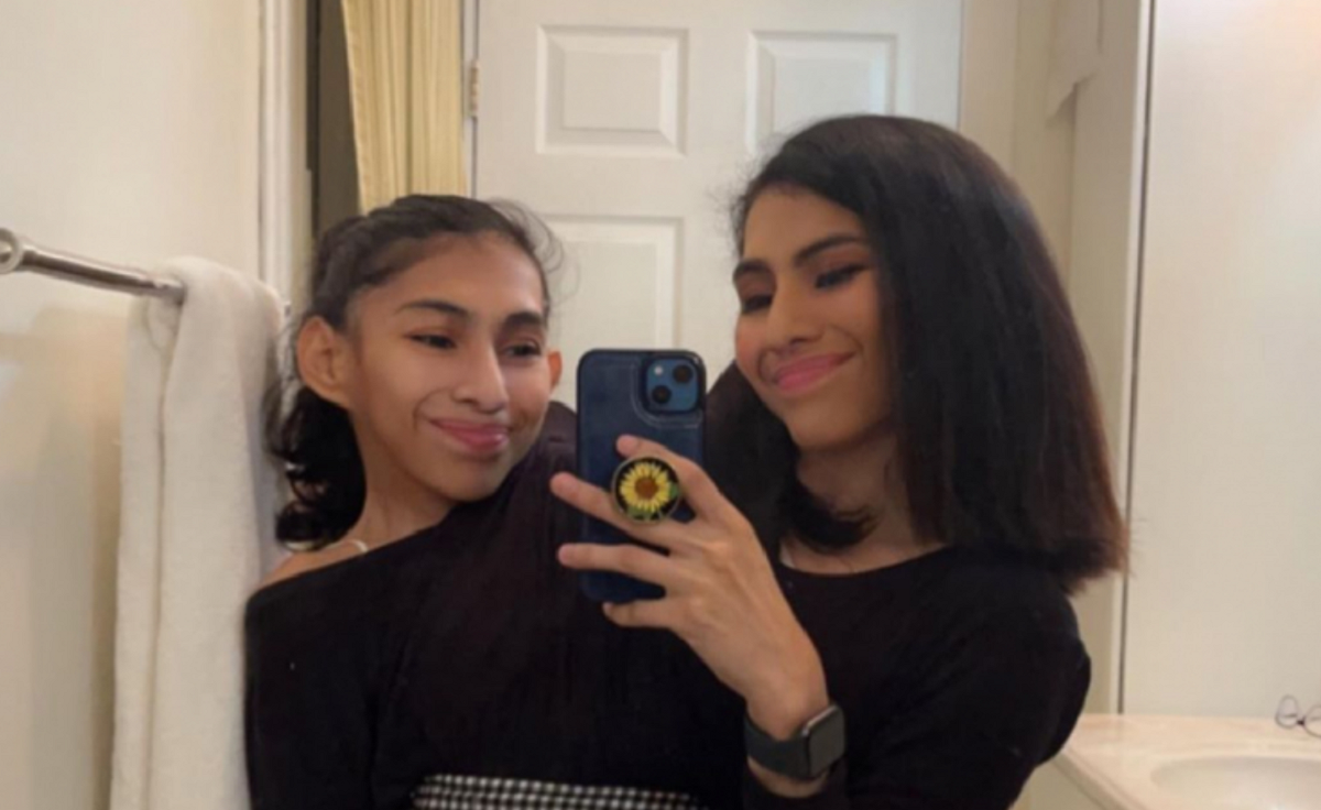 Imagine Stire Incredibil! Cum arată o zi normală din viața gemenelor siameze Carmen și Lupita Andrade: ”Am primit mesaje de la tipi cu fetișuri” | 2review.ro