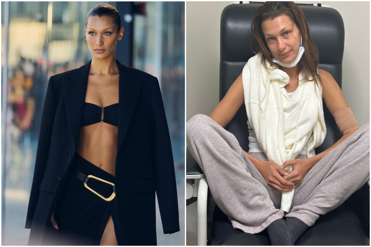 Imagine Stire Boala de care suferă Bella Hadid. La 15 ani, modelul a primit diagnosticul crunt: ”S-a înrăutățit cu timpul” | 2review.ro
