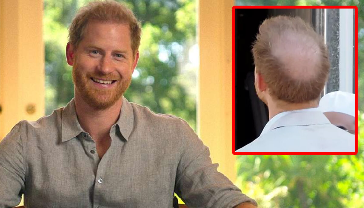 Imagine Stire S-a aflat adevăratul motiv pentru care Prințul Harry chelește. Are legătură cu Meghan Markle | 2review.ro