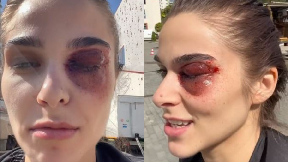 Imagine Stire Apariție terifiantă a lui Theo Rose! Artista s-a filmat cu un ochi vânăt: „Cum am ajuns în situația asta?” | 2review.ro