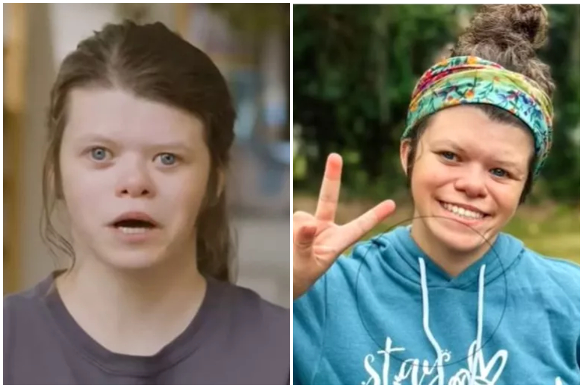 Tânăra din imagine suferă de o afecțiune extrem de rară, se îndrăgostește de oricine! Ce este sindromul Williams și cum se manifestă 