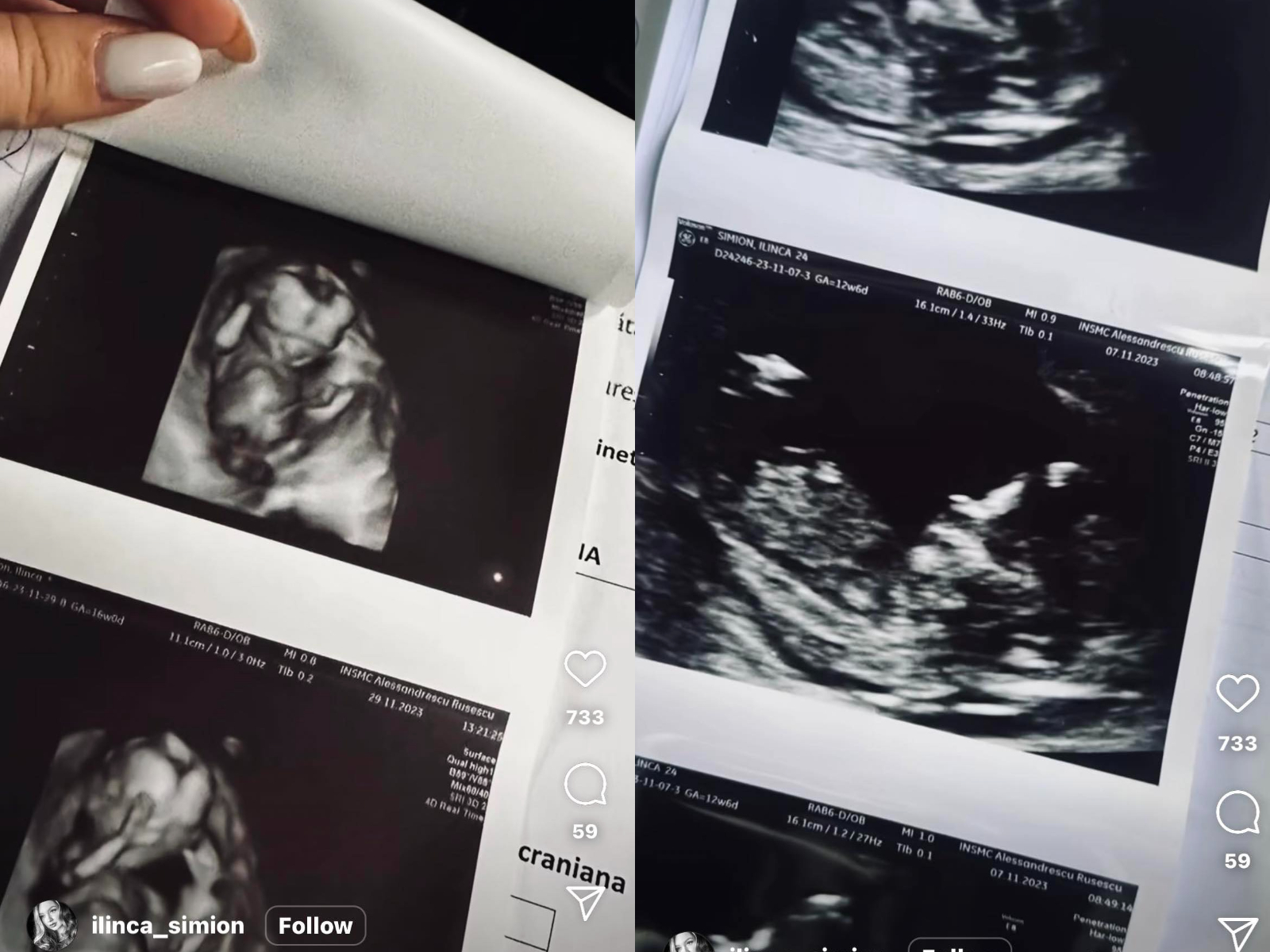 george simion si ilinca