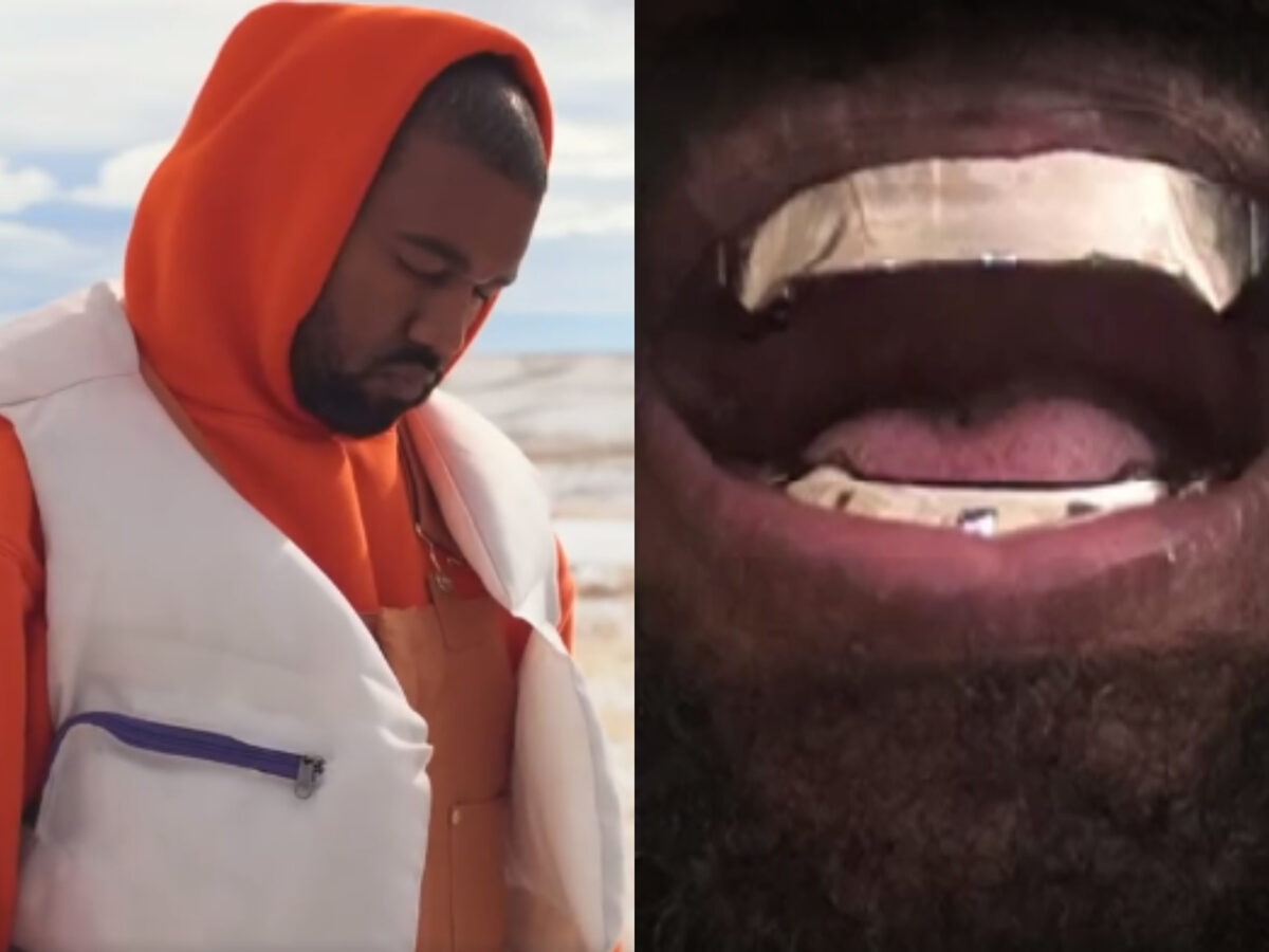 Kanye West și-a înlocuit toți dinții cu proteze de titan, în valoare de 850 de mii de dolari! Rapper-ul a avut ca model un film cu James Bond