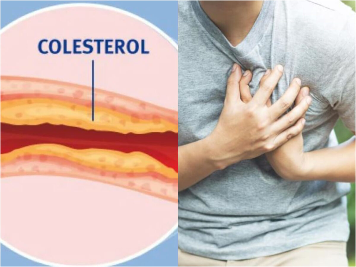 Alimentul surprinzător care scade colesterolul. Mulţi s-ar gândi că îngraşă
