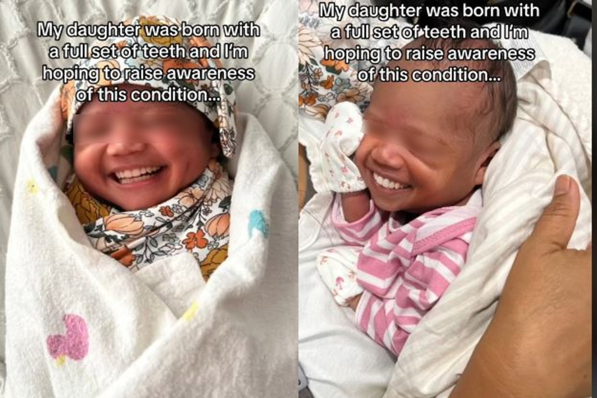 Un bebeluș s-a născut cu dantura completă! Cazul care i-a uluit pe medici: ”Nu am mai văzut așa ceva!”