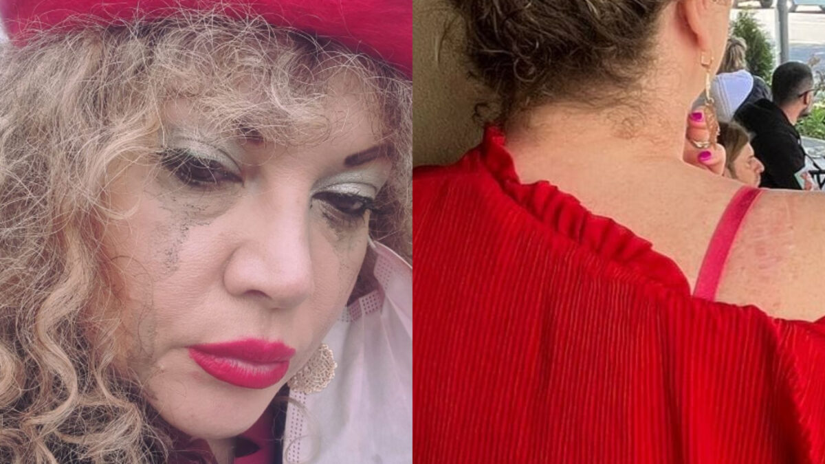 Imagine Stire Oana Lis, diagnosticată cu cancer de piele. Imaginea cutremurătoare pe care a postat-o soția lui Viorel Lis | 2review.ro