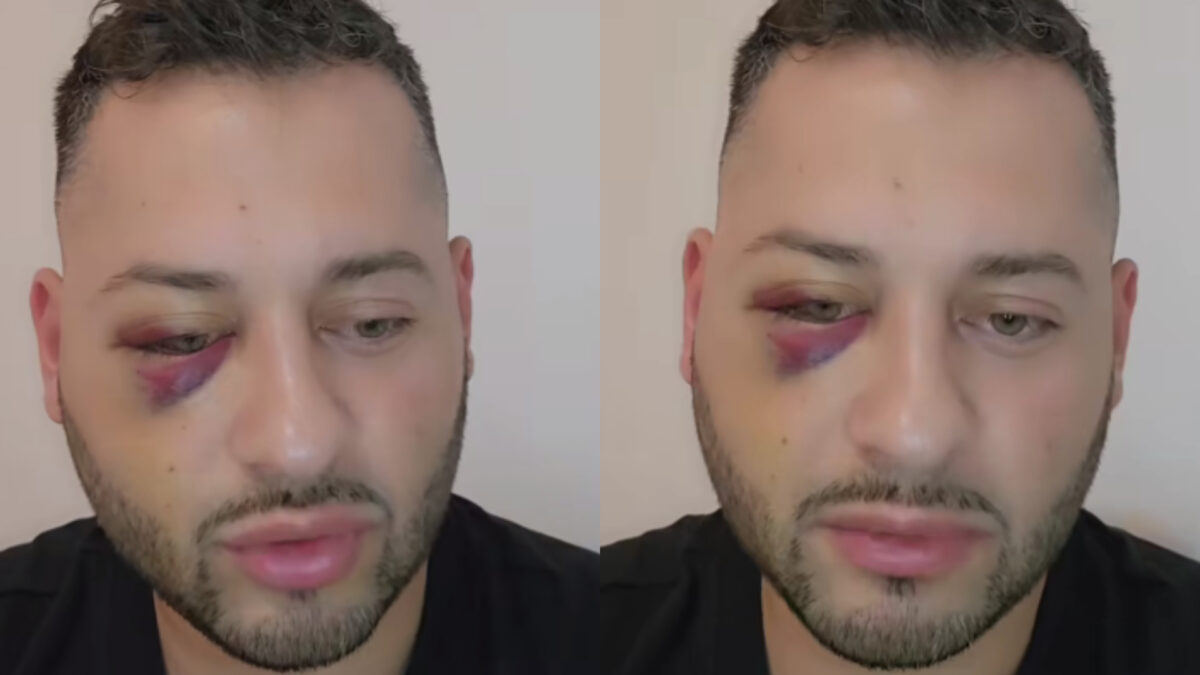 Imagine Stire Mărturisiri crunte făcute de Daniel Balaș după episodul violent de pe litoral. Ce s-a întâmplat, de fapt, între fostul preot și bătăușii care l-au băgat în spital: ”Prostia mea a fost că…” | 2review.ro