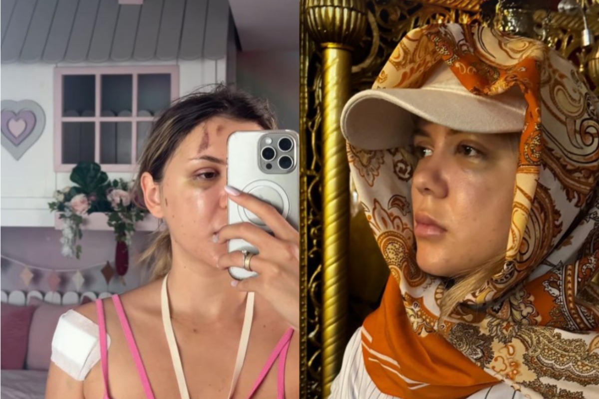 Prima imagine cu Emily Burghelea după ce a ieșit din operație. Fanii s-au cutremurat când au văzut-o