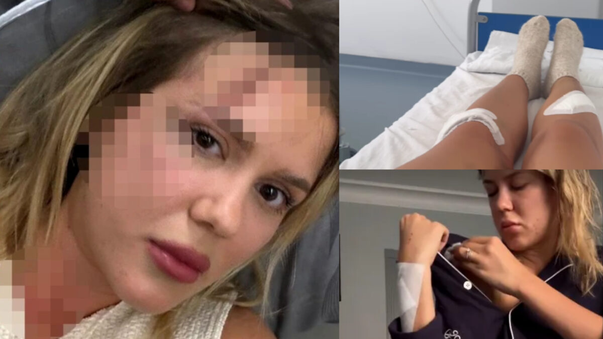Imagine Stire Emily Burghelea, rasă în cap înainte de operație! Diagnosticul crunt primit de la medici: ”Nu știu dacă ceva o să mai fie la fel” | 2review.ro