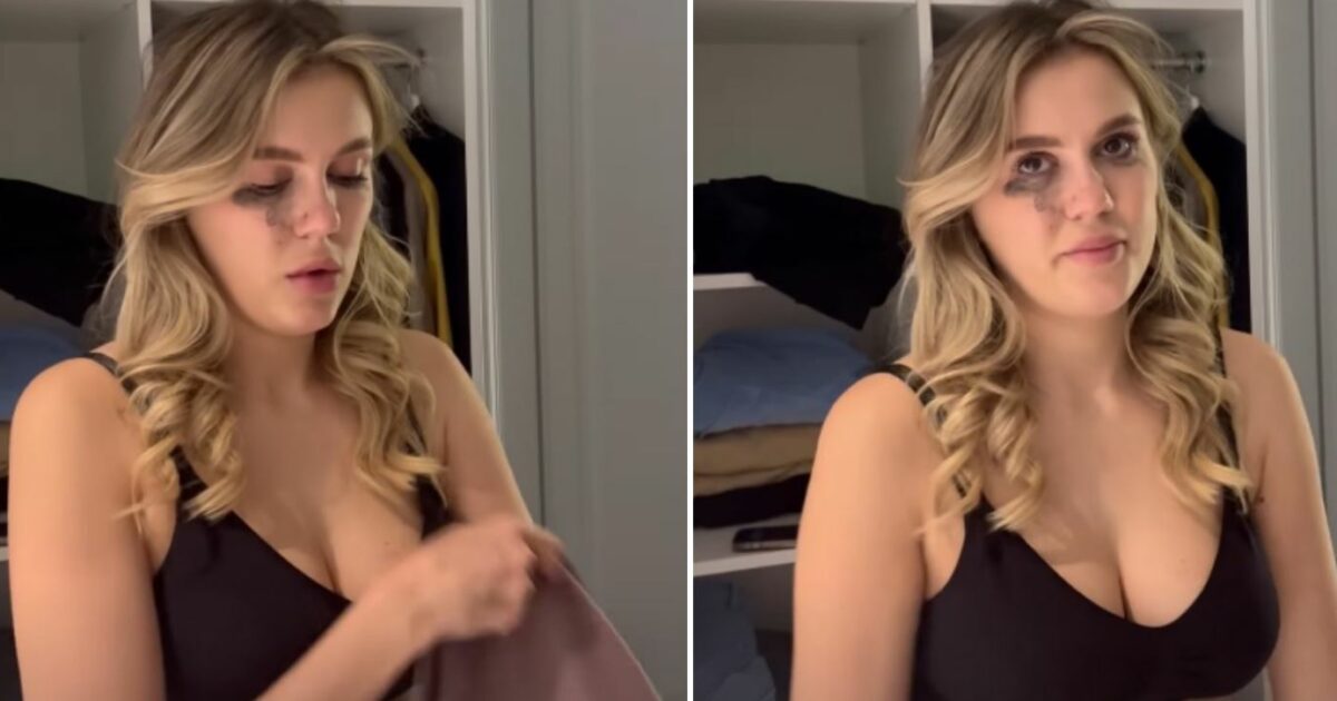 Imagine Stire Emily Burghelea, tumefiată pe internet! Fanii sunt îngroziți: ”E un miracol că am rămas în viață” | 2review.ro