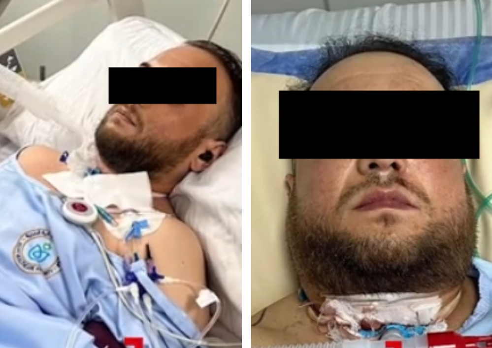 Românul atacat în Egipt. Sursă foto: Observator