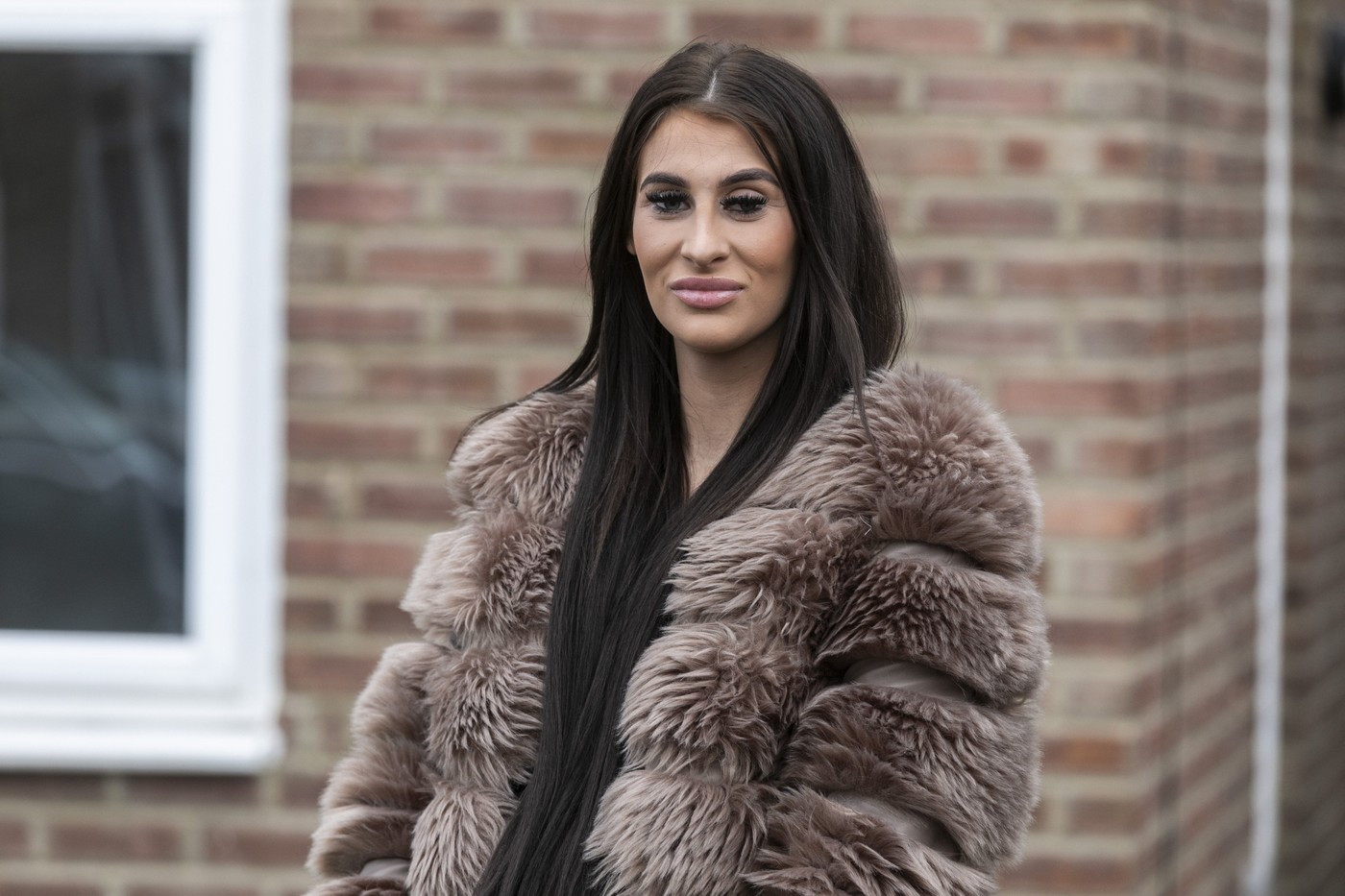 Coșmarul trăit de femeia care este alergică la apă! Ce se întâmplă când și doar o picătură de ploaie îi atinge pielea