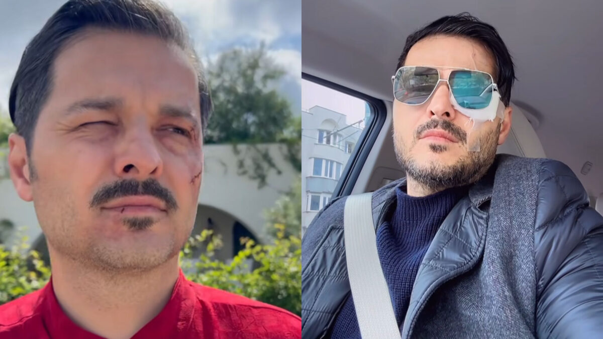 Liviu Vârciu, de urgență la spital după ce a suferit un accident: ”M-a ferit Dumnezeu, că puteam să fiu…”