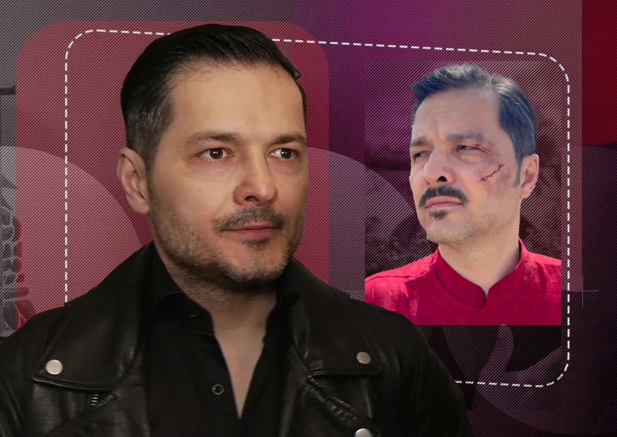 În ce stare se află Liviu Vârciu, după accidentul neaşteptat. Ce tratament strict i-au prescris medicii: “Un milimetru și îmi pierdeam ochiul”