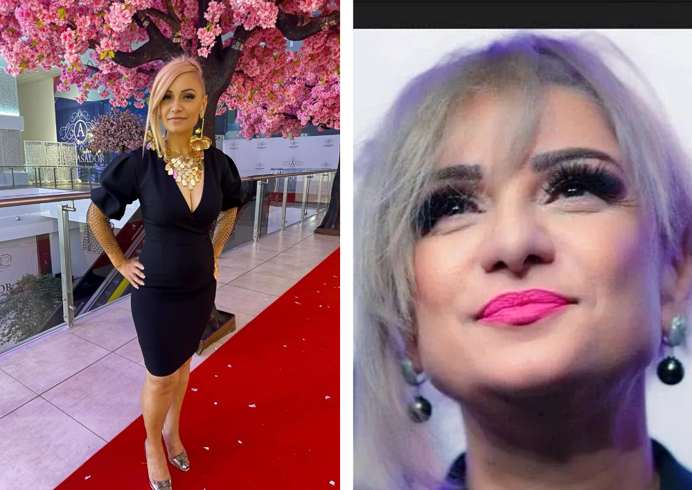 Cauza morții artistei Emilia Istvan. De ce s-a stins din viață Mili de la Timișoara