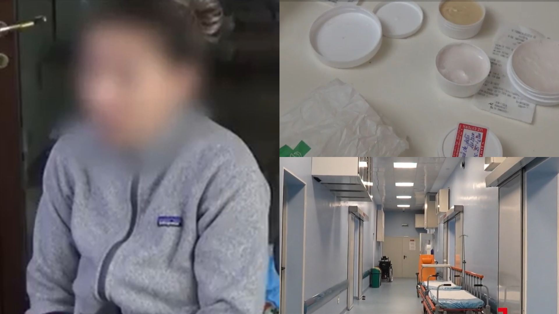 Ce conținea crema de 500 de lei care a băgat-o pe Ramona din Bistrița în spital! A fost în mare pericol: „M-am trezit desfigurată”