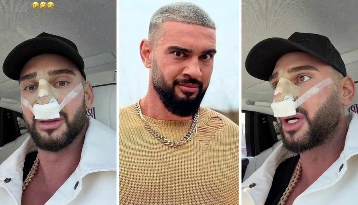 Dorian Popa, la un pas să îi „cadă nasul ca lui Michael Jackson”! Ce i-a descoperit medicul la operație? „Habar nu aveam”