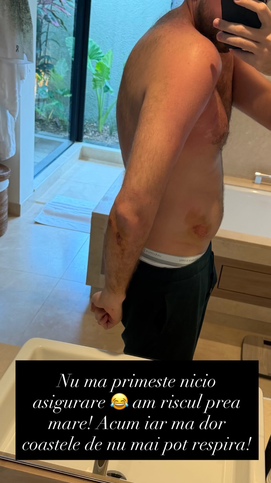 Soțul lui Emily Burghelea s-a accidentat în vacanță! SURSA FOTO: iubitul_lui_emily/Instagram.