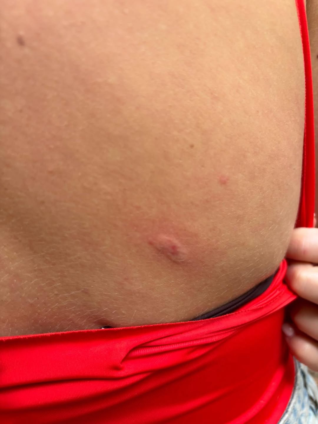 Monica Odagiu, mușcată de maimuță. Sursa foto: Instagram