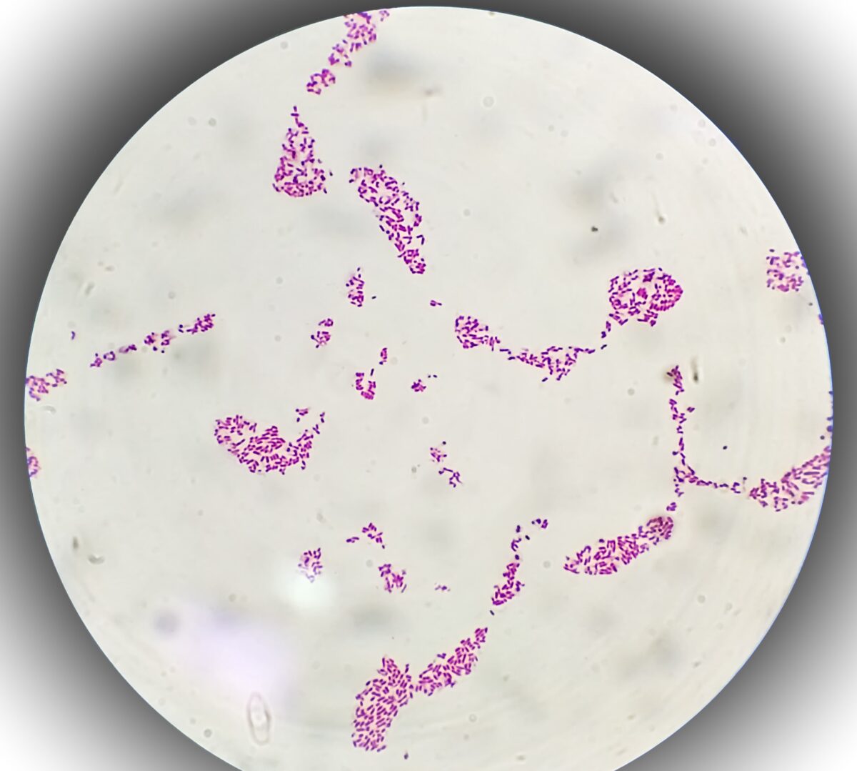 Imagine Stire O boală veche de milenii devine tot mai rezistentă la antibiotice. Avertismentul cercetătorilor | 2review.ro