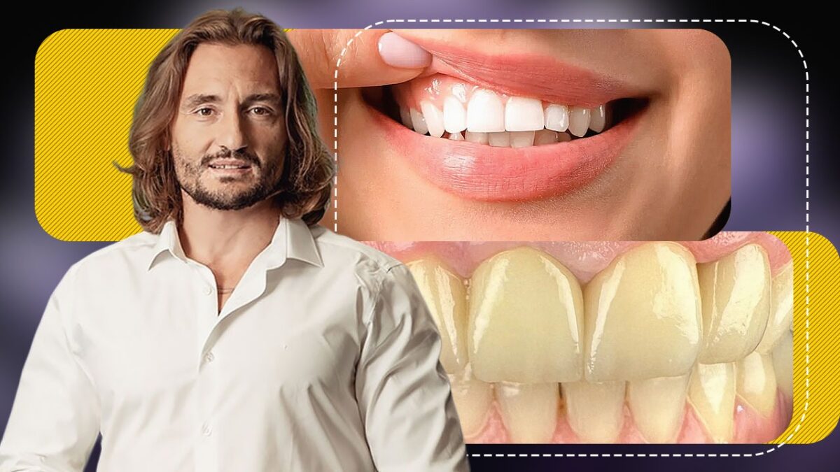 Imagine Stire Cum își pot albi românii dinții în mod natural? Ce spune Dr. Cezar despre smalț, dentină și rolul unei vitamine importante | 2review.ro