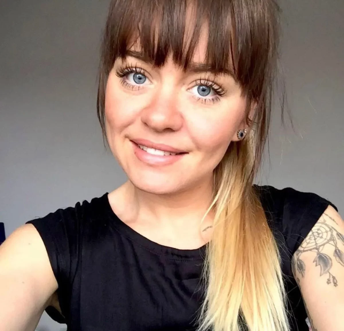 Imagine Stire I-a fost îndepărtată o aluniță, iar apoi a murit. Ce s-a întâmplat, de fapt, cu această femeie de 37 de ani | 2review.ro