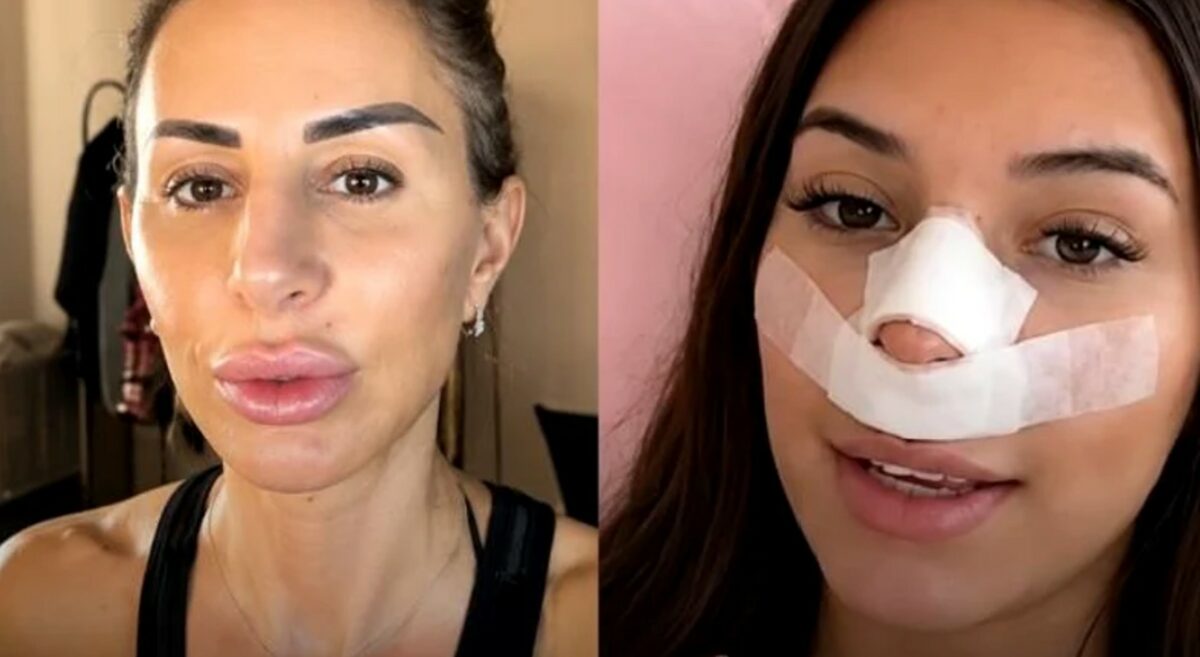 Imagine Stire Val de reacții după ce o influenceriță s-a operat, pentru ca viitorii copii să nu îi moștenească nasul | 2review.ro