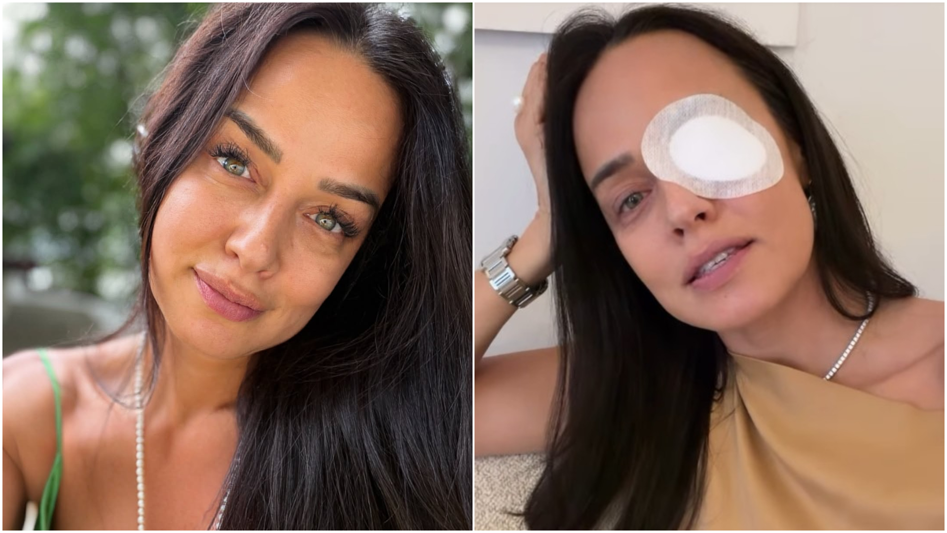 Andreea Raicu, cu ochiul bandajat după un accident domestic