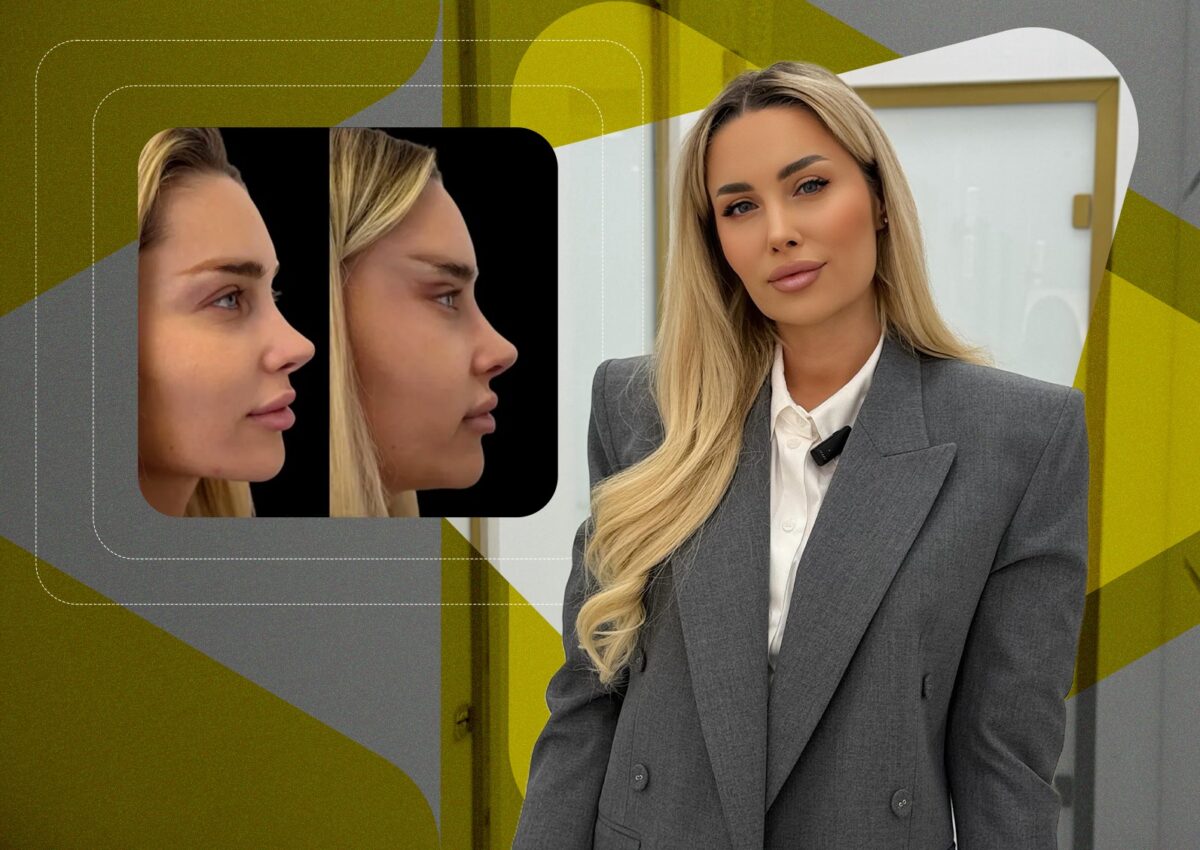 Oana Monea spune adevărul despre operațiile estetice care au scandalizat internetul: „Nu mi-am ridicat fața!”