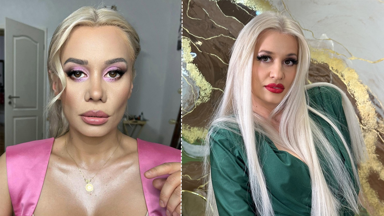Anisia, înainte și după operația la nas
