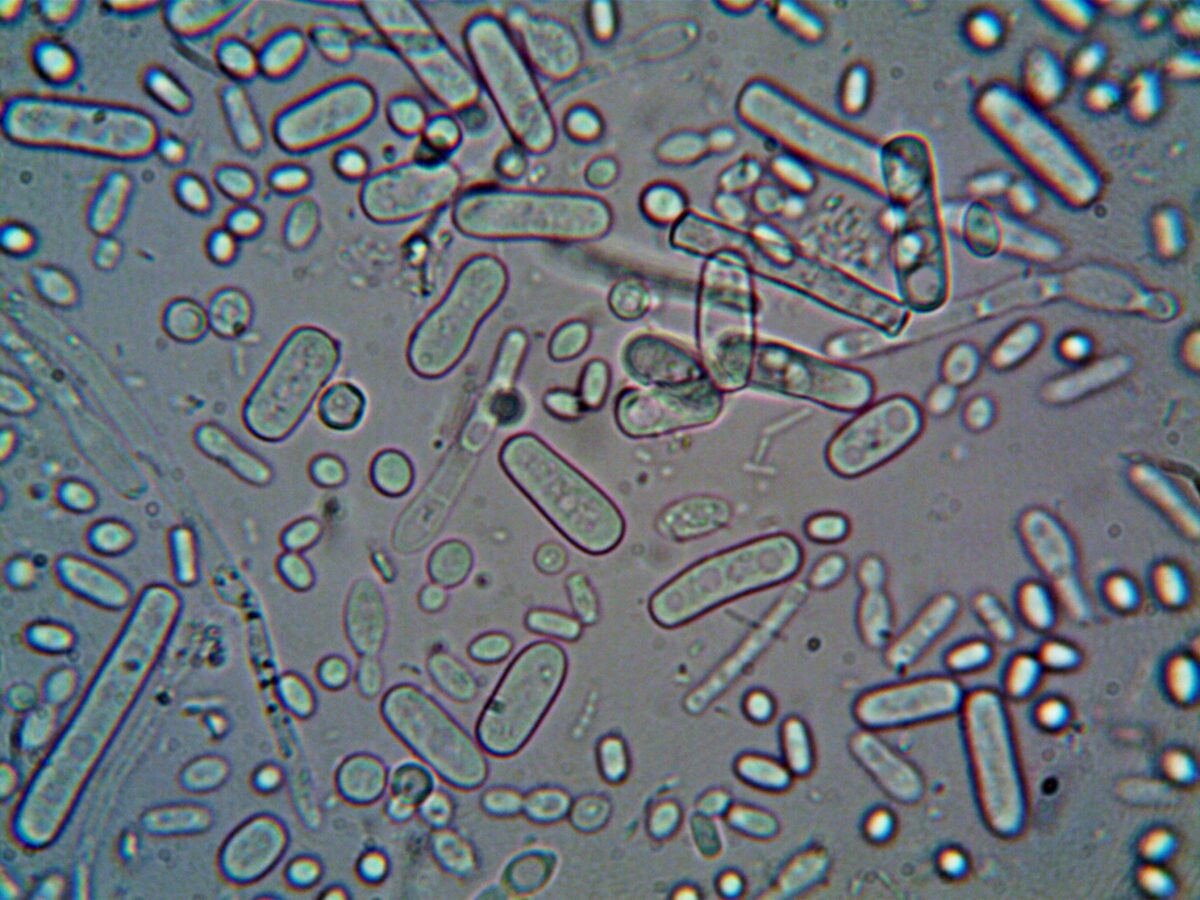 Bacteria care face tot mai multe victime în apele din America! Cinci oameni au murit deja