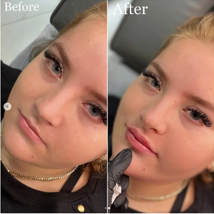 tatiana final boss si-a marit buzele cu acid hialuronic (1)